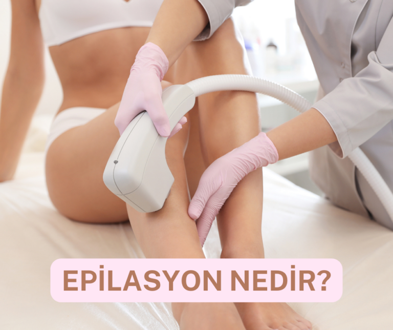 epilasyon nedir