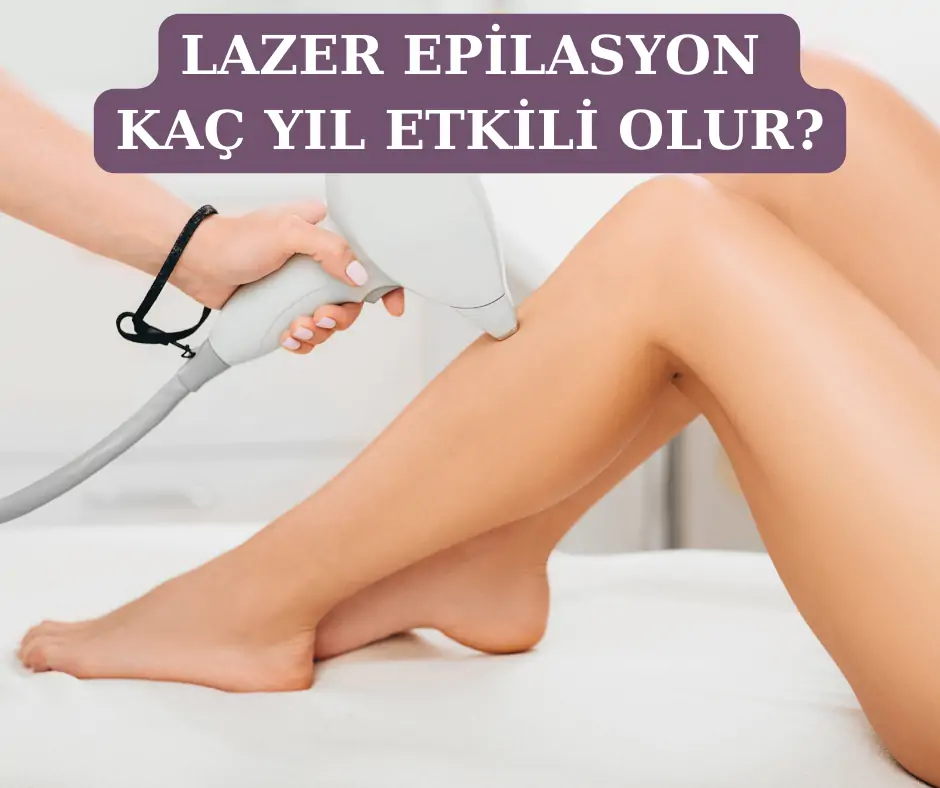 lazer epilasyon kaç yıl etkili